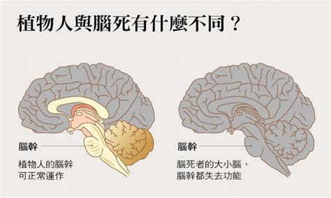 腦漿溢出還能活嗎|腦死了怎麼辦